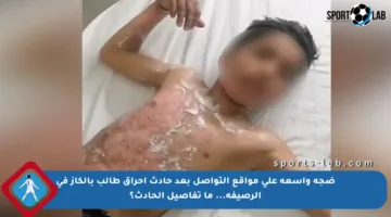 ضجة واسعة على مواقع التواصل بعد حادث إحراق طالب بالكاز في الرصيفة… ما تفاصيل الحادث؟
